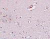 Immunohistochemistry of ZNF536 in human brain tissue with ZNF536 antibody at 5 ug/mL.