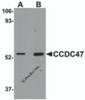 Western blot analysis of CCDC47 in mouse heart tissue lysate with CCDC47 antibody at (A) 1 and (B) 2 &#956;g/mL.
