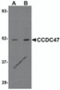 Western blot analysis of CCDC47 in mouse heart tissue lysate with CCDC47 antibody at (A) 1 and (B) 2 &#956;g/mL.