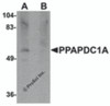 Western blot analysis of PPAPDC1A in human brain tissue lysate with PPAPDC1A antibody at 1 &#956;g/mL in (A) the absence and (B) the presence of blocking peptide.