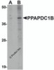 Western blot analysis of PPAPDC1B in EL4 cell lysate with PPAPDC1B antibody at (A) 1 and (B) 2 &#956;g/mL.