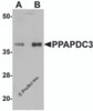 Western blot analysis of PPAPDC3 in mouse heart tissue lysate with PPAPDC3 antibody at (A) 1 and (B) 2 &#956;g/mL.