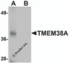 Western blot analysis of TMEM38A in rat skeletal muscle tissue lysate with TMEM38A antibody at 1 &#956;g/mL in (A) the absence and (B) the presence of blocking peptide.