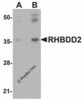 Western blot analysis of RHBDD2 in rat lung tissue lysate with RHBDD2 antibody at (A) 1 and (B) 2 &#956;g/mL.
