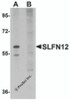 Western blot analysis of SLFN12 in SK-N-SH cell lysate with SLFN12 antibody at 1 &#956;g/mL in (A) the absence and (B) the presence of blocking peptide.
