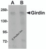 Western blot analysis of Girdin in rat brain tissue lysate with Girdin antibody at (A) 1 and (B) 2 &#956;g/mL.