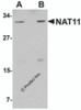 Western blot analysis of NAT11 in human thymus tissue lysate with NAT11 antibody at (A) 1 and (B) 2 &#956;g/mL.