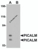 Western blot analysis of PICALM in EL4 cell lysate with PICALM antibody at 1 &#956;g/mL in (A) the absence and (B) the presence of blocking peptide.