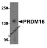 Western blot analysis of PRDM16 in K562 cell lysate with PRDM16 antibody at 1 &#956;g/mL.