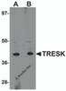 Western blot analysis of TRESK in rat brain tissue lysate with TRESK antibody at (A) 1 and (B) 2 &#956;g/mL.