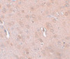 Immunohistochemistry of TRESK in rat brain tissue with TRESK antibody at 5 ug/mL.