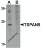 Western blot analysis of TSPAN9 in EL4 cell lysate with TSPAN9 antibody at 1 &#956;g/mL in (A) the absence and (B) the presence of blocking peptide.