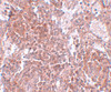 Immunohistochemistry of TSPAN9 in human spleen tissue with TSPAN9 antibody at 2.5 ug/mL.