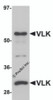 Western blot analysis of VLK in human lung tissue lysate with VLK antibody at 1 &#956;g/mL.