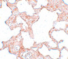 Immunohistochemistry of VLK in rat lung tissue with VLK antibody at 2.5 ug/mL.