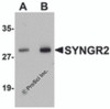 Western blot analysis of SYNGR2 in human lung tissue lysate with SYNGR2 antibody at (A) 1 and (B) 2 &#956;g/mL.