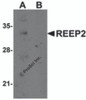 Western blot analysis of REEP2 in mouse lung tissue lysate with REEP2 antibody at 1 &#956;g/mL in (A) the absence and (B) the presence of blocking peptide.