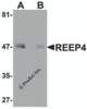 Western blot analysis of REEP4 in human lung tissue lysate with REEP4 antibody at 1 &#956;g/ml in (A) the absence and (B) the presence of blocking peptide.