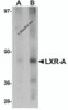 Western blot analysis of LXR-A in rat liver tissue lysate with LXR-A antibody at (A) 1 and (B) 2 &#956;g/mL.