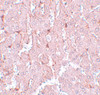 Immunohistochemistry of LXR-A in rat liver tissue with LXR-A antibody at 5 ug/mL.