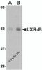 Western blot analysis of LXR-B in human lung tissue lysate with LXR-B antibody at (A) 1 and (B) 2 &#956;g/mL.