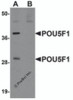Western blot analysis of POU5F1 in mouse liver tissue lysate with POU5F1 antibody at 1 &#956;g/ml in (A) the absence and (B) the presence of blocking peptide.