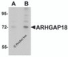 Western blot analysis of ARHGAP18 in 3T3 cell lysate with ARHGAP18 antibody at (A) 1 and (B) 2 &#956;g/mL.