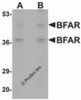 Western blot analysis of BFAR in human kidney tissue lysate with BFAR antibody at (A) 1 and (B) 2 &#956;g/mL.