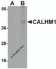 Western blot analysis of CALHM1 in rat liver tissue lysate with CALHM1 antibody at (A) 1 and (B) 2 &#956;g/mL.