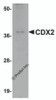 Western blot analysis of CDX2 in mouse brain tissue lysate with CDX2 antibody at 1 &#956;g/mL.