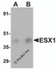 Western blot analysis of ESX1 in human testis tissue lysate with ESX1 antibody at (A) 1 and (B) 2 &#956;g/mL.