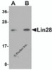 Western blot analysis of Lin28 in Raji cell lysate with Lin28 antibody at (A) 1 and (B) 2 &#956;g/mL.