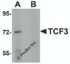 Western blot analysis of TCF3 in Human brain tissue lysate with TCF3 antibody at 1 &#956;g/mL in (A) the absence and (B) presence of peptide blocking.
