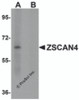 Western blot analysis of ZSCAN4 in mouse lung tissue lysate with ZSCAN4 antibody in (A) the absence and (B) presence of blocking peptide.