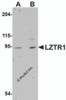 Western blot analysis of LZTR1 in human heart tissue lysate with LZTR1 antibody at (A) 1 and (B) 2 &#956;g/mL.