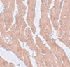 Immunohistochemistry of LZTR1 in mouse heart tissue with LZTR1 antibody at 5 ug/mL.