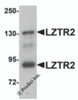 Western blot analysis of LZTR2 in mouse kidney tissue lysate with LZTR2 antibody at 1 &#956;g/mL.