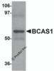 Western blot analysis of BCAS1 in human lung tissue lysate with BCAS1 antibody at 1 &#956;g/mL.