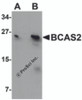 Western blot analysis of BCAS2 in MCF7 cell lysate with BCAS2 antibody at (A) 0.5 and (B) 1 &#956;g/mL.
