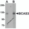 Western blot analysis of BCAS3 in rat brain tissue lysate with BCAS3 antibody at (A) 0.5 and (B) 1 &#956;g/mL.