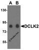 Western blot analysis of DCLK2 in rat brain tissue lysate with DCLK2 antibody at (A) 1 and (B) 2 &#956;g/mL.