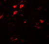 Immunofluorescence of DLCK3 in human brain tissue with DLCK3 antibody at 20 ug/mL.