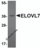 Western blot analysis of ELOVL7 in human liver tissue lysate with ELOVL7 antibody at 1 &#956;g/mL.