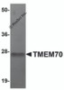 Western blot analysis of TMEM70 in human liver tissue lysate with TMEM70 antibody at 1 &#956;g/mL.