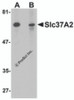 Western blot analysis of Slc37A2 in mouse spleen tissue lysate with Slc37A2 antibody at 1 &#956;g/mL in the (A) absence and (B) presence of blocking peptide.