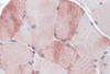 Immunohistochemistry of MYBPC1 in human skeletal muscle tissue with MYBPC1 antibody at 5 &#956;g/mL.