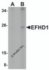 Western blot analysis of EFHD1 in human spleen tissue lysate with EFHD1 antibody at (A) 2 and (B) 4 &#956;g/mL.