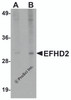 Western blot analysis of EFHD2 in mouse brain tissue lysate with EFHD2 antibody at (A) 1 and (B) 2 &#956;g/mL.