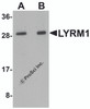 Western blot analysis of LYRM1 in human liver tissue lysate with LYRM1 antibody at (A) 1 and (B) 2 &#956;g/mL.