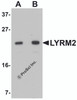 Western blot analysis of LYRM2 in A549 cell lysate with LYRM2 antibody at (A) 1 and (B) 2 &#956;g/mL.